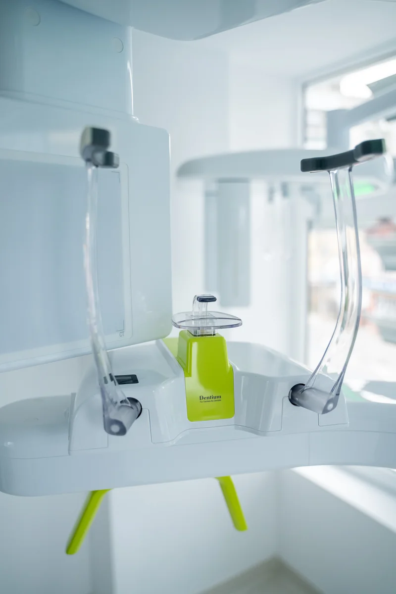 Detaliu al aparatului CBCT de la DentalCare Sîrbu, cu suportul pentru poziționarea capului