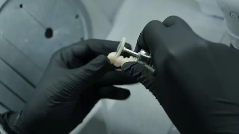 Lucrare dentară finisată în laboratorul propriu DentalCare Sîrbu
