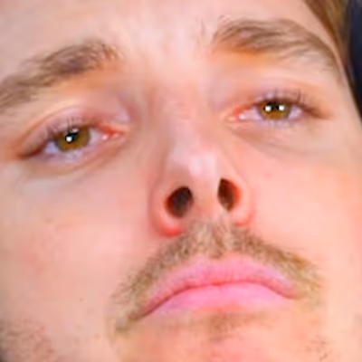 Lazar Beam