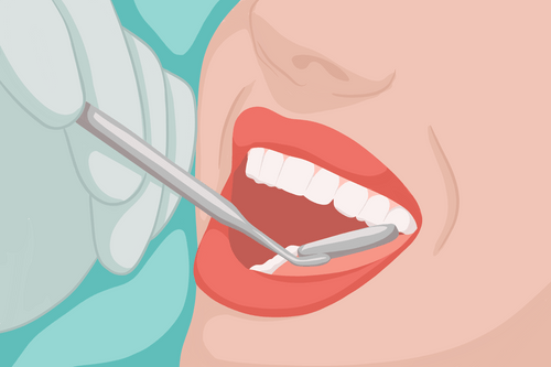 Dépistage du cancer buccal Oral Cancer Screening