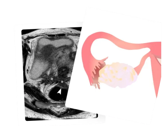 Ovarian Reserve Test