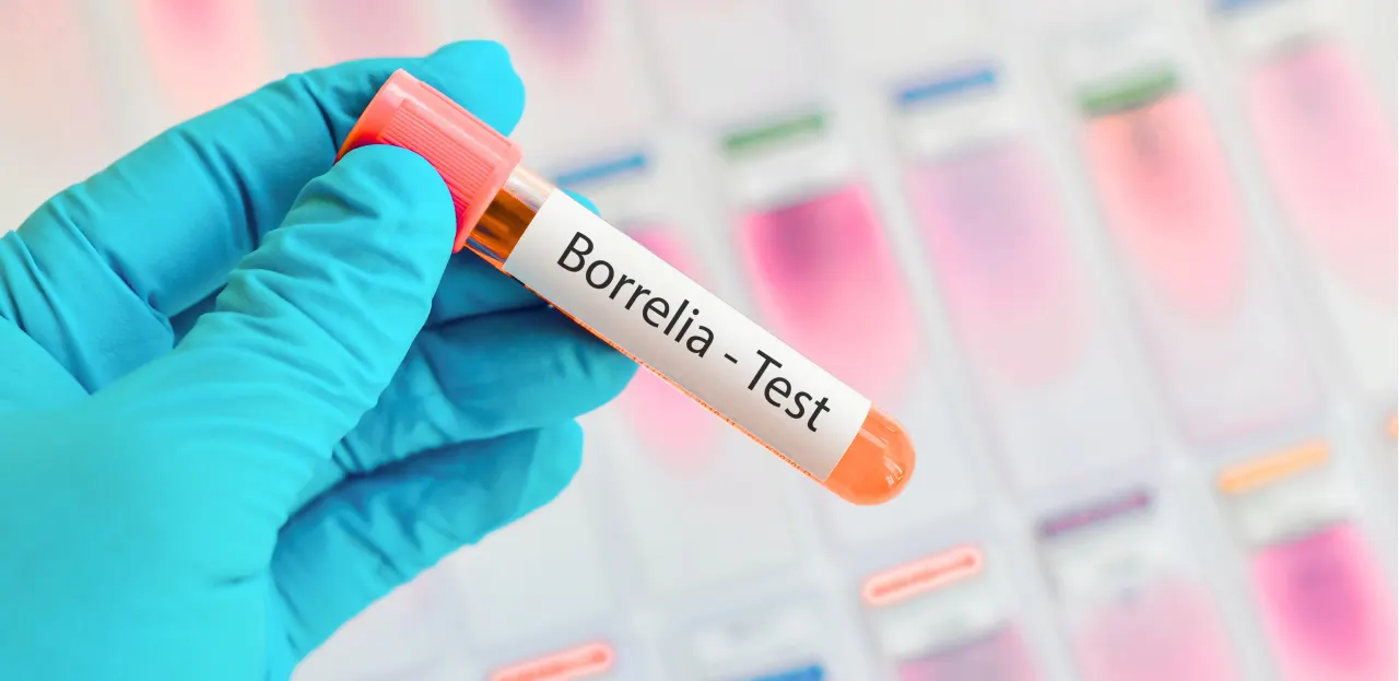 Zkumavka s odběrem krve označená Borrelia test