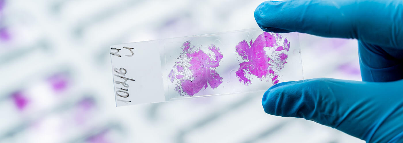 Cancer research
