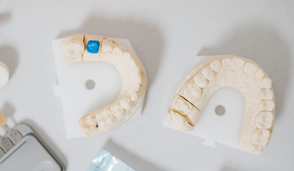 Waking Up With a Sore Jaw? What Nighttime Grinding Is Doing to Your Smile
