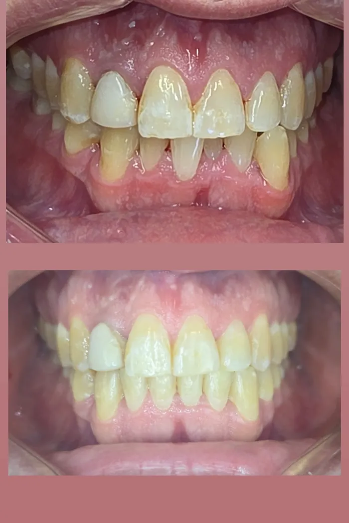 Restored shape and natural symmetry