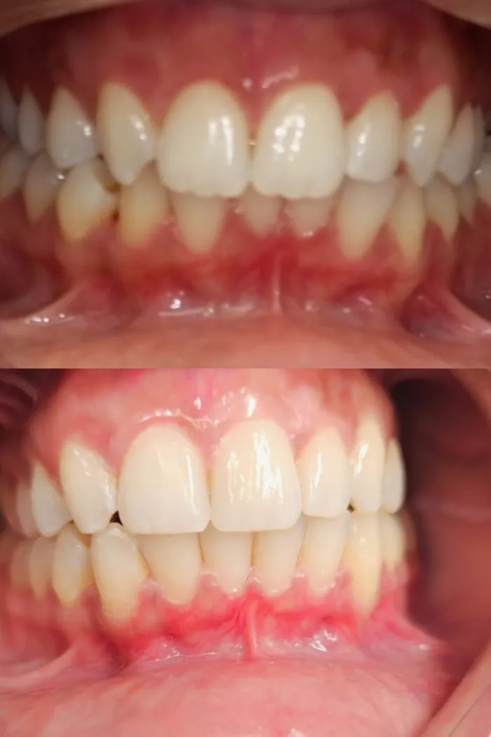 A softer, more balanced smile