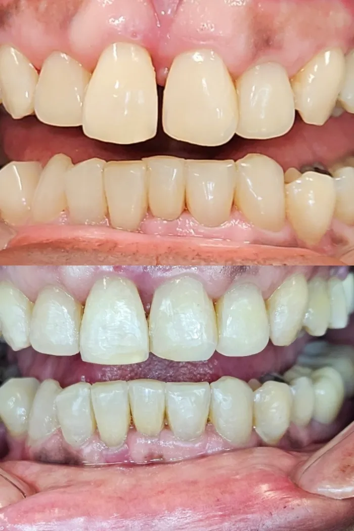 Chipped edges smoothed and repaired