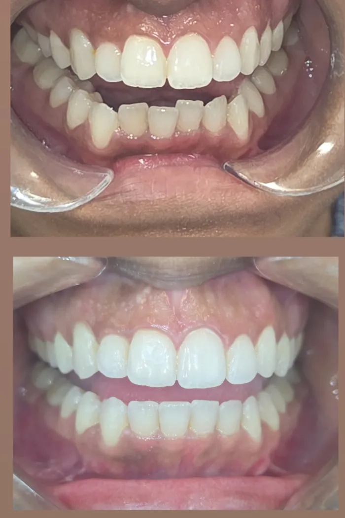 A wider, more open smile