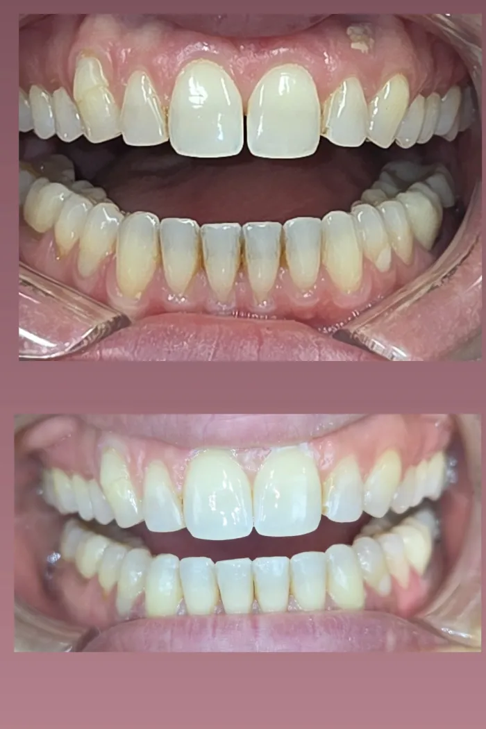 A refreshed, healthy-looking smile
