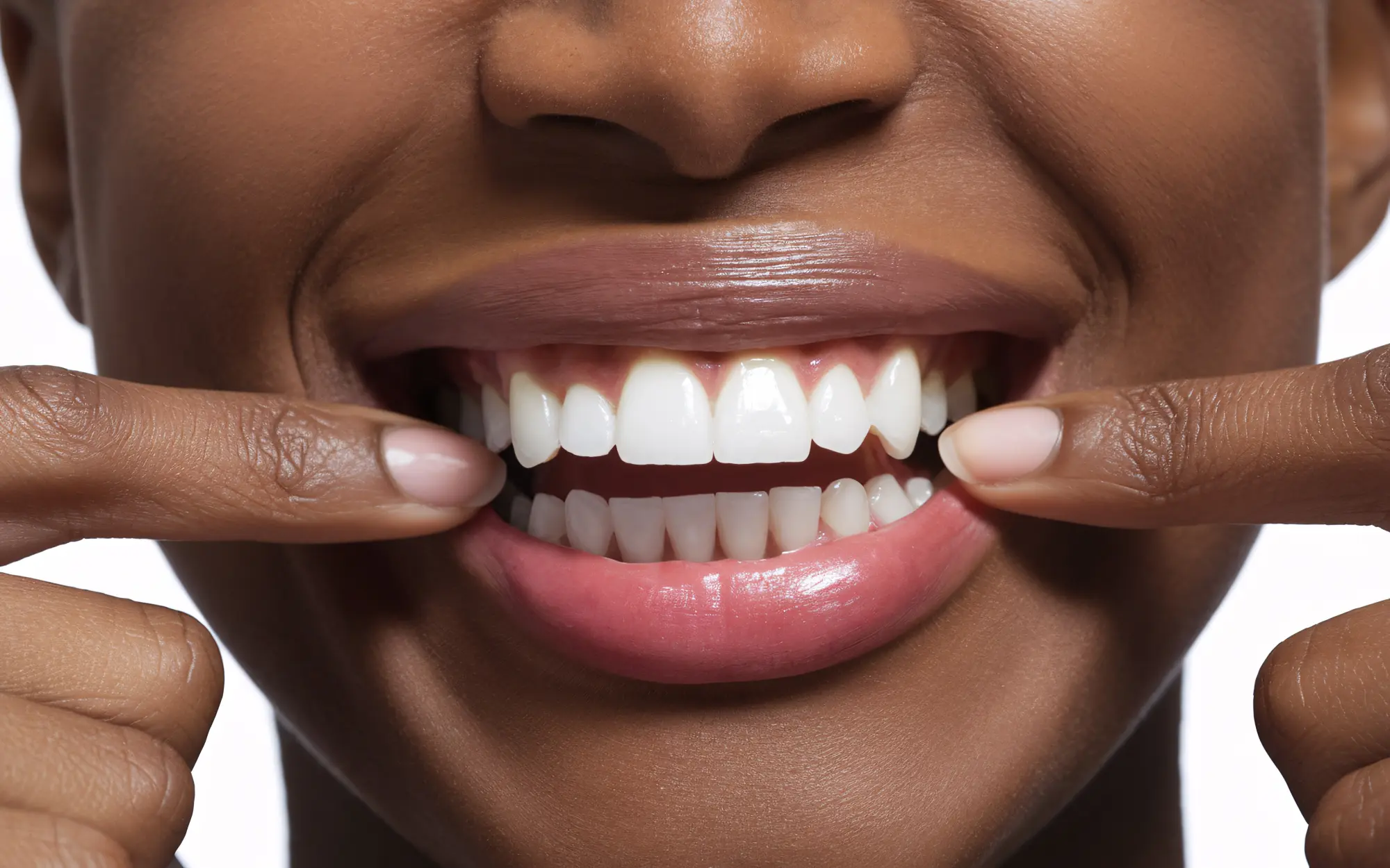 Teeth Whitening in Barrington | Express Dental Studio