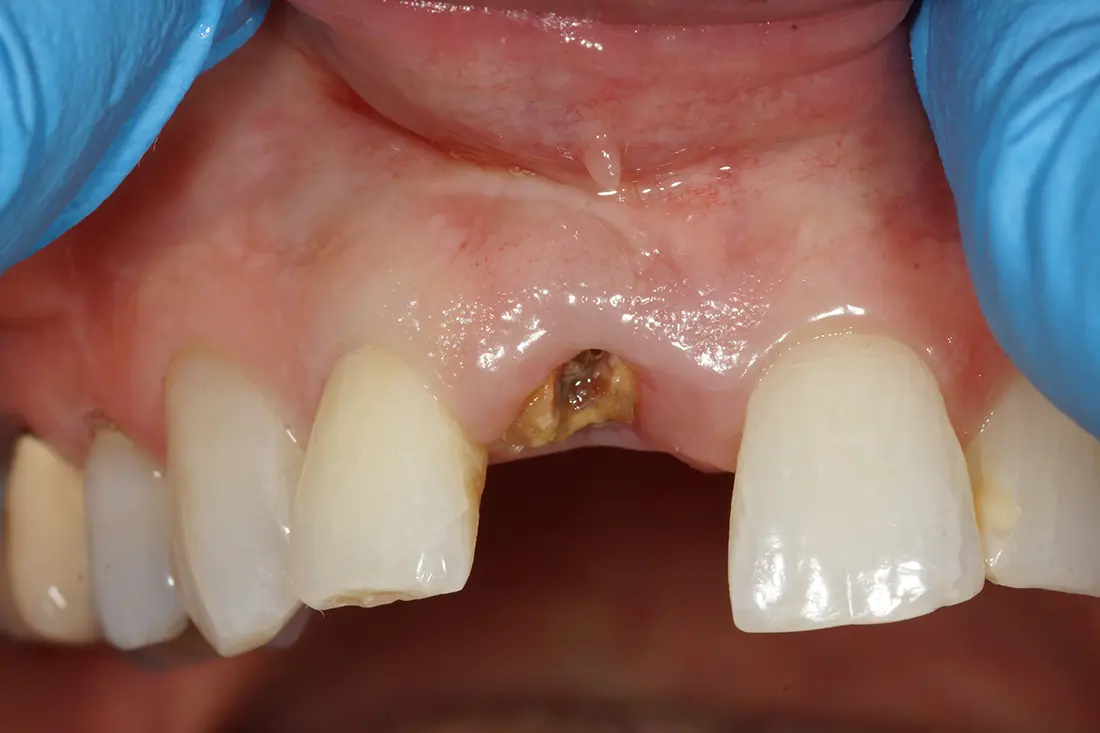 before and after treatment