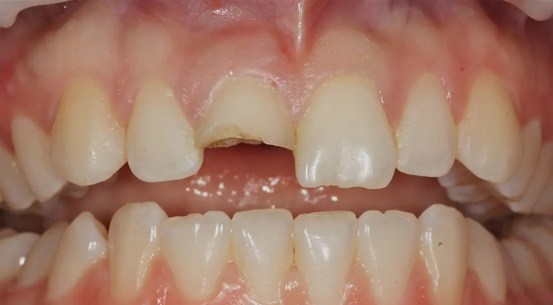 before and after treatment