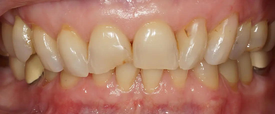 before and after treatment