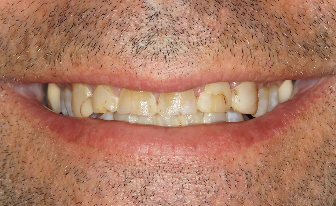 before and after treatment