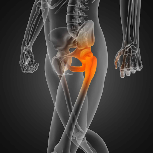 image highlighting where hip pain could be