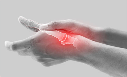 Image depicting pain in the thumb joint