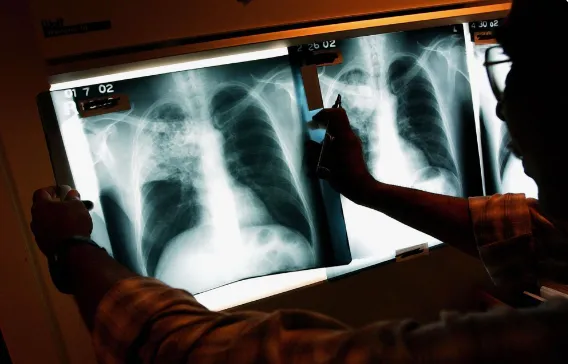 lightspeed-leads-65-million-round-by-india-ai-diagnostics-firm