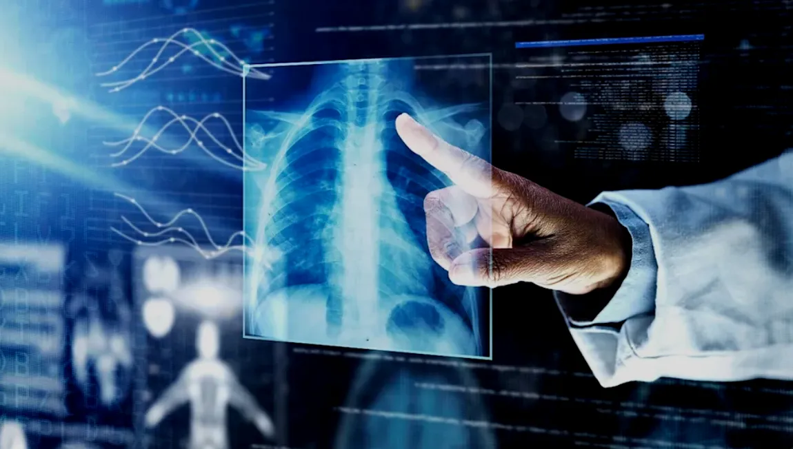 university-hospitals-cleveland-set-to-evaluate-ai-for-early-lung-cancer-detection-2
