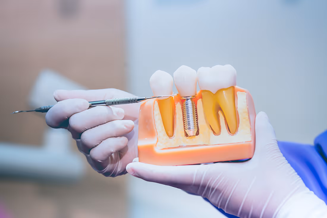 tooth and mirror tool