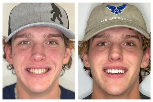 tooth and mirror tool