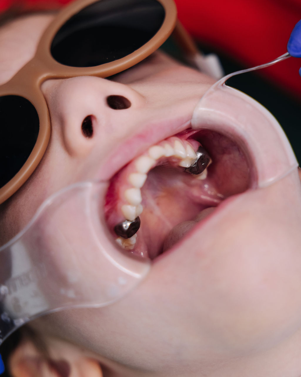 tooth and mirror tool