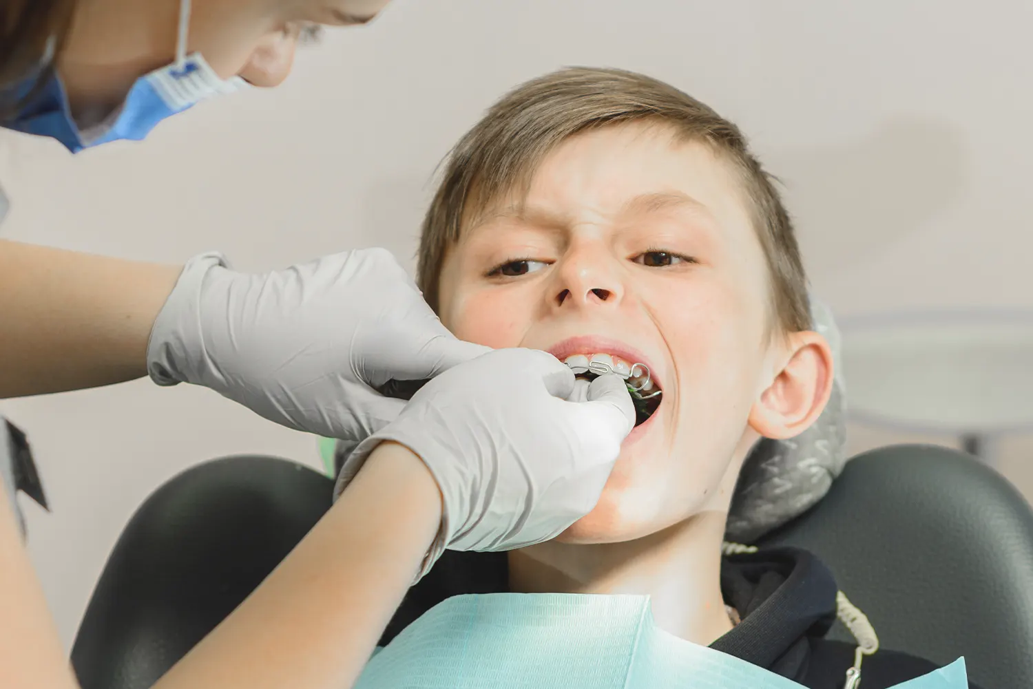 Beyond the Braces: How Myofunctional Therapy Prevents Orthodontic Relapse