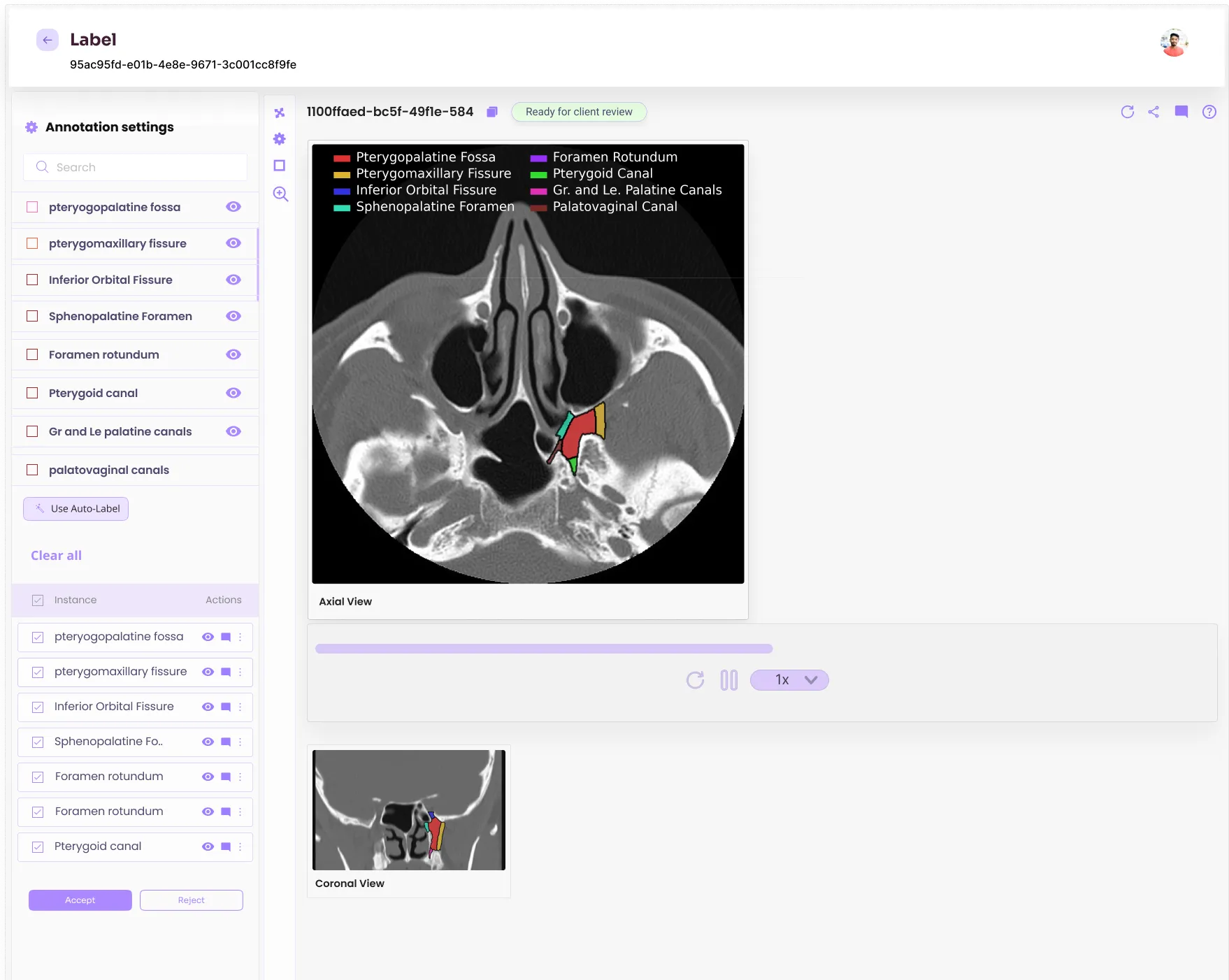 Customize Image Annotation Pipeline
