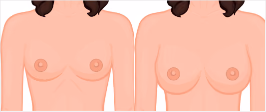 What makes FUE Hair Transplant Procedure the most Successful Technique?