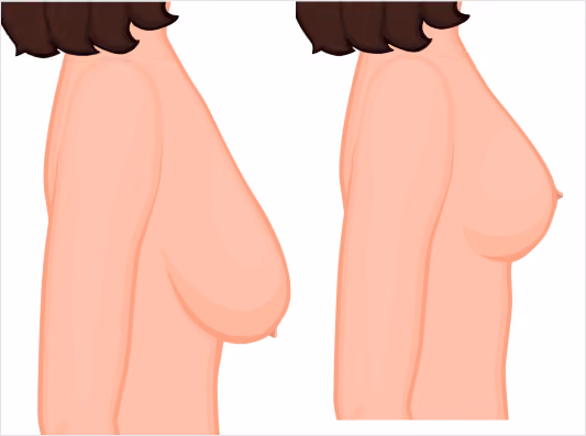 What makes FUE Hair Transplant Procedure the most Successful Technique?