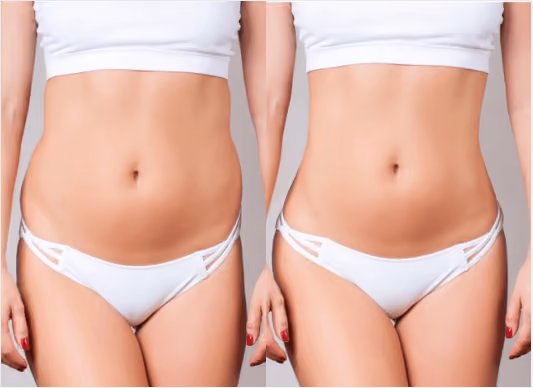 What makes FUE Hair Transplant Procedure the most Successful Technique?