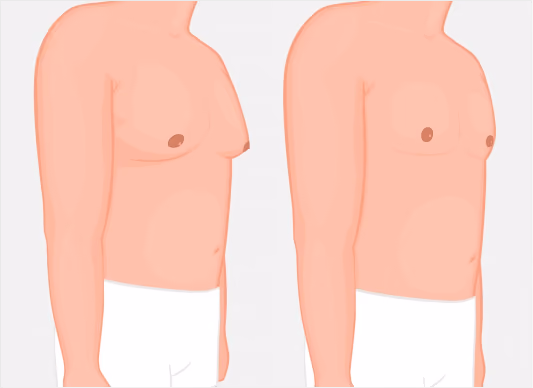 What makes FUE Hair Transplant Procedure the most Successful Technique?