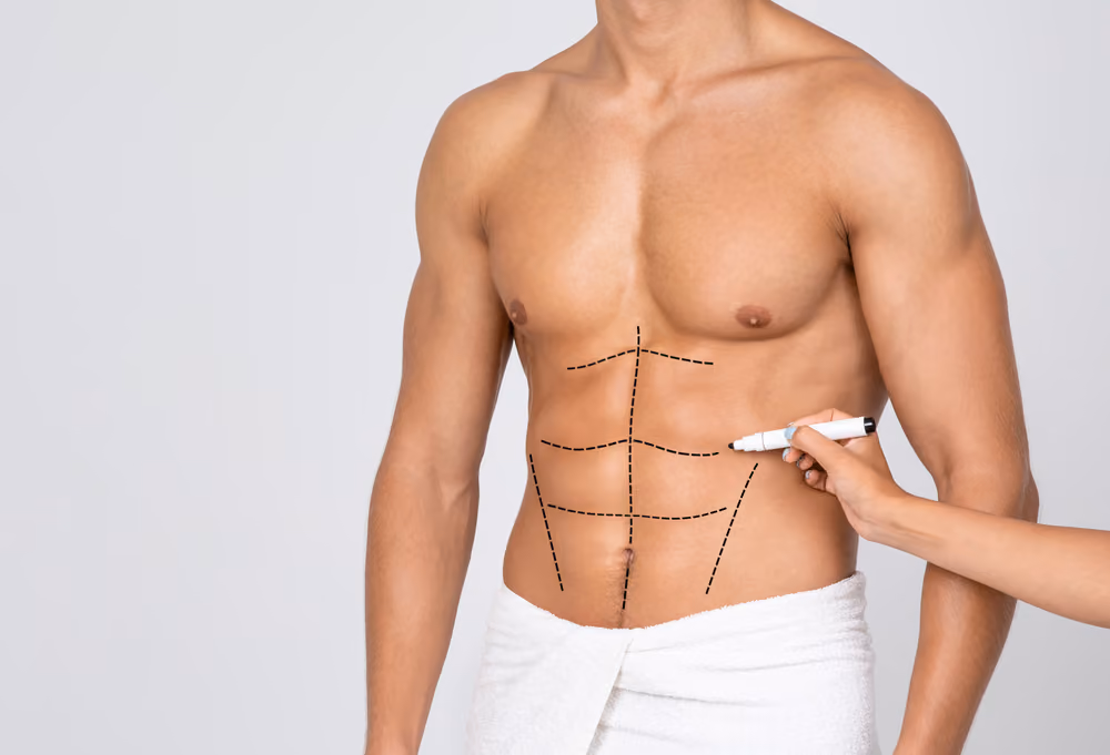 What makes FUE Hair Transplant Procedure the most Successful Technique?
