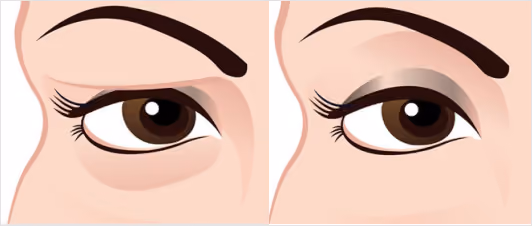 Personalised Consultation & Treatment Plan
