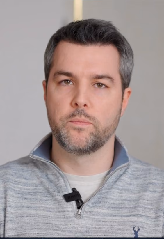 Jason Mitchell hair transplant - Este