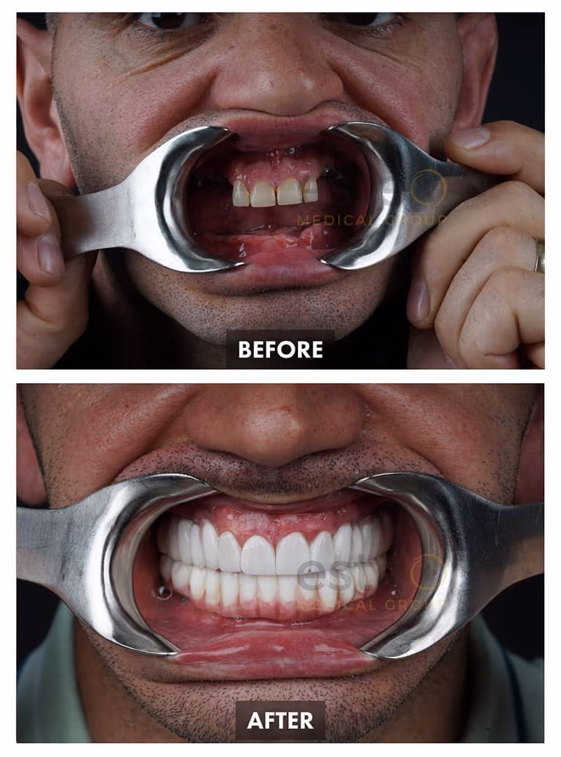 Cosmetic Dentistry Results