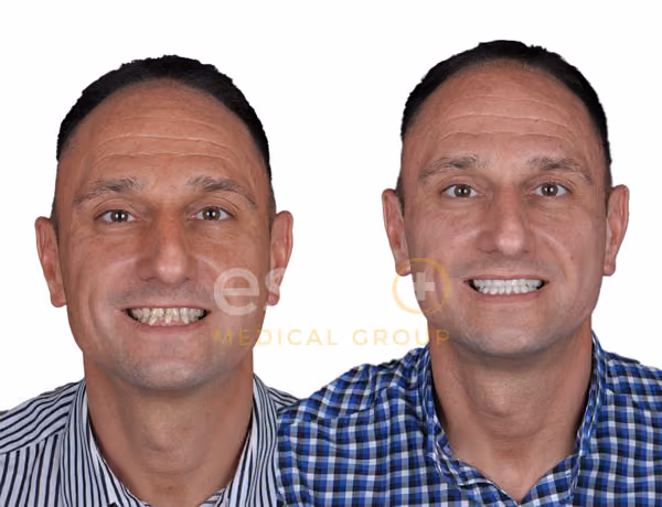 Dentistry Before After - Este UK
