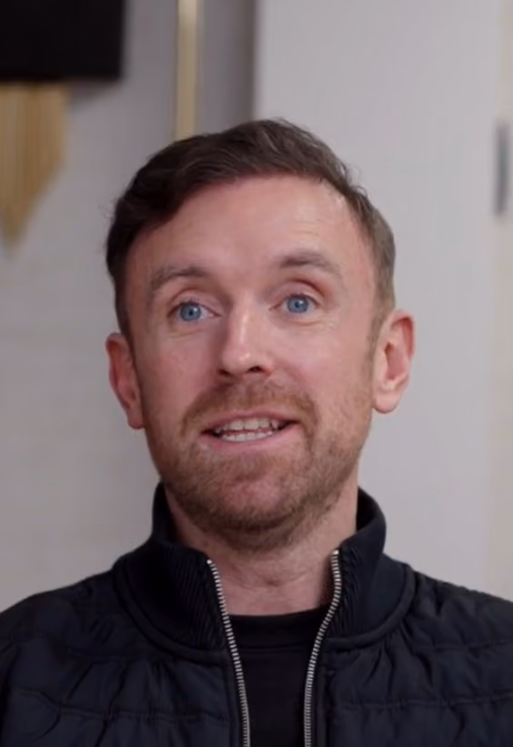 Steve Cavanagh before after Hair transplant