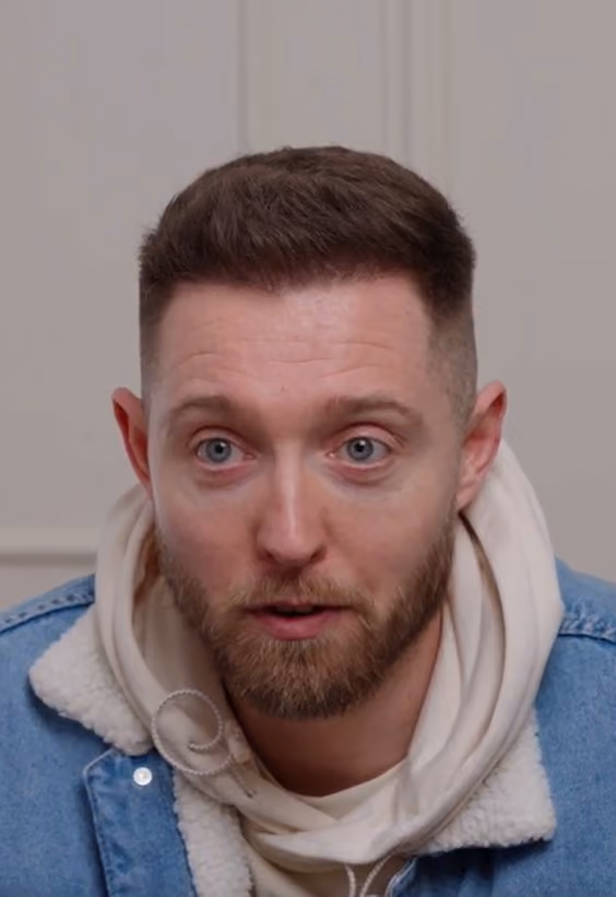 Martin Hair Transplant story image