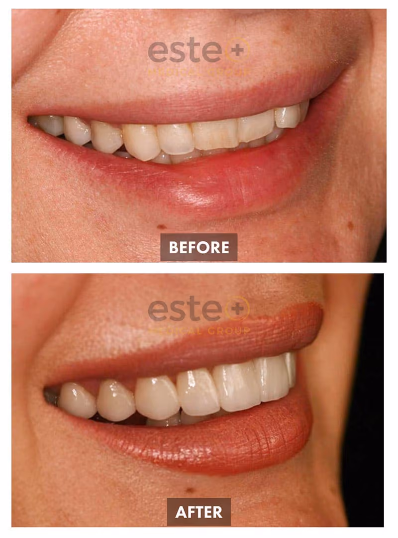 Cosmetic Dentistry Results