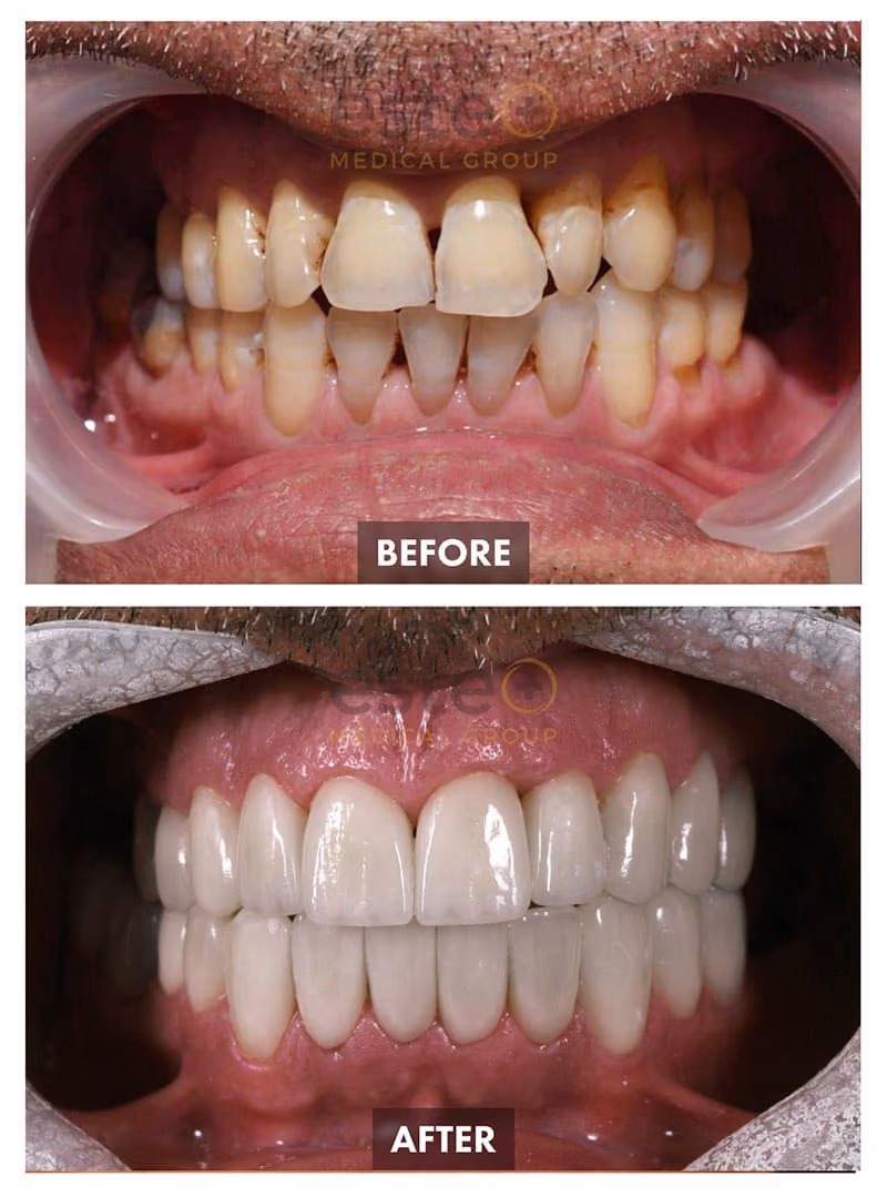 Dentistry Before-after Images - Este