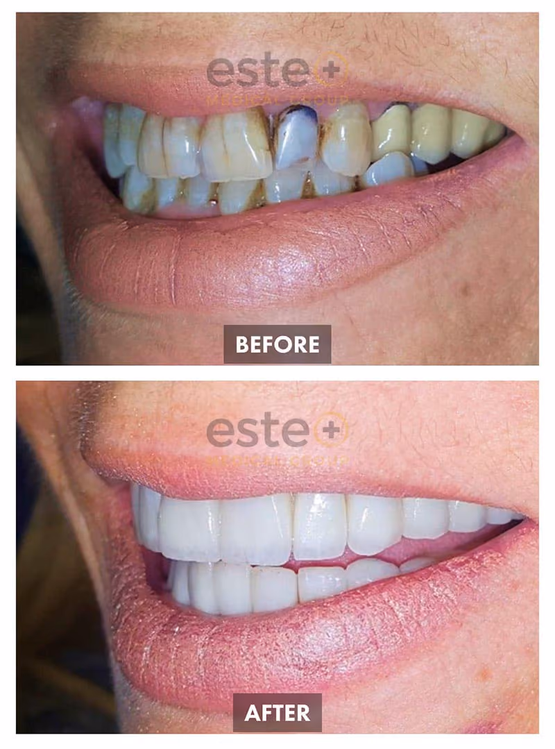 Cosmetic Dentistry Results