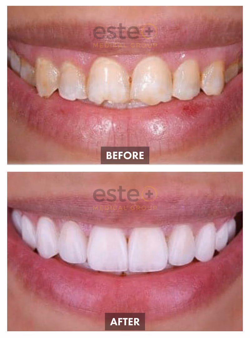 Cosmetic Dentistry Results
