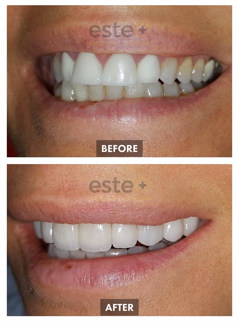 Cosmetic Dentistry Results