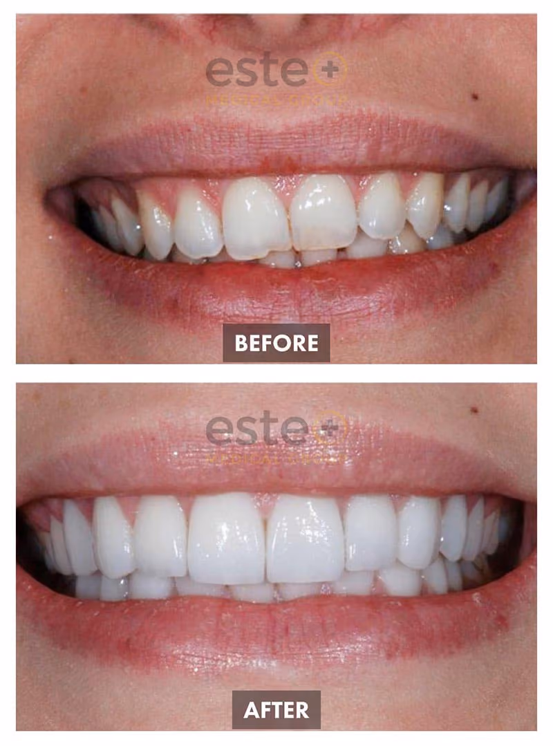 Cosmetic Dentistry Results