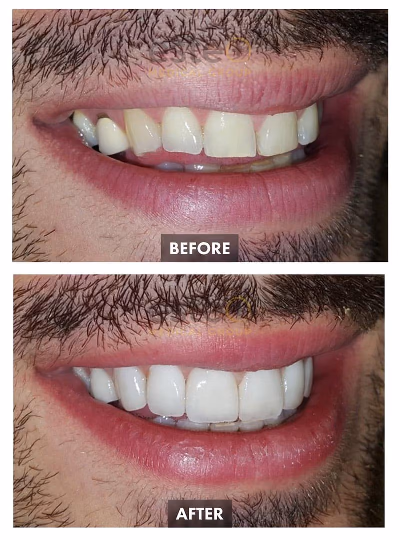 Cosmetic Dentistry Results