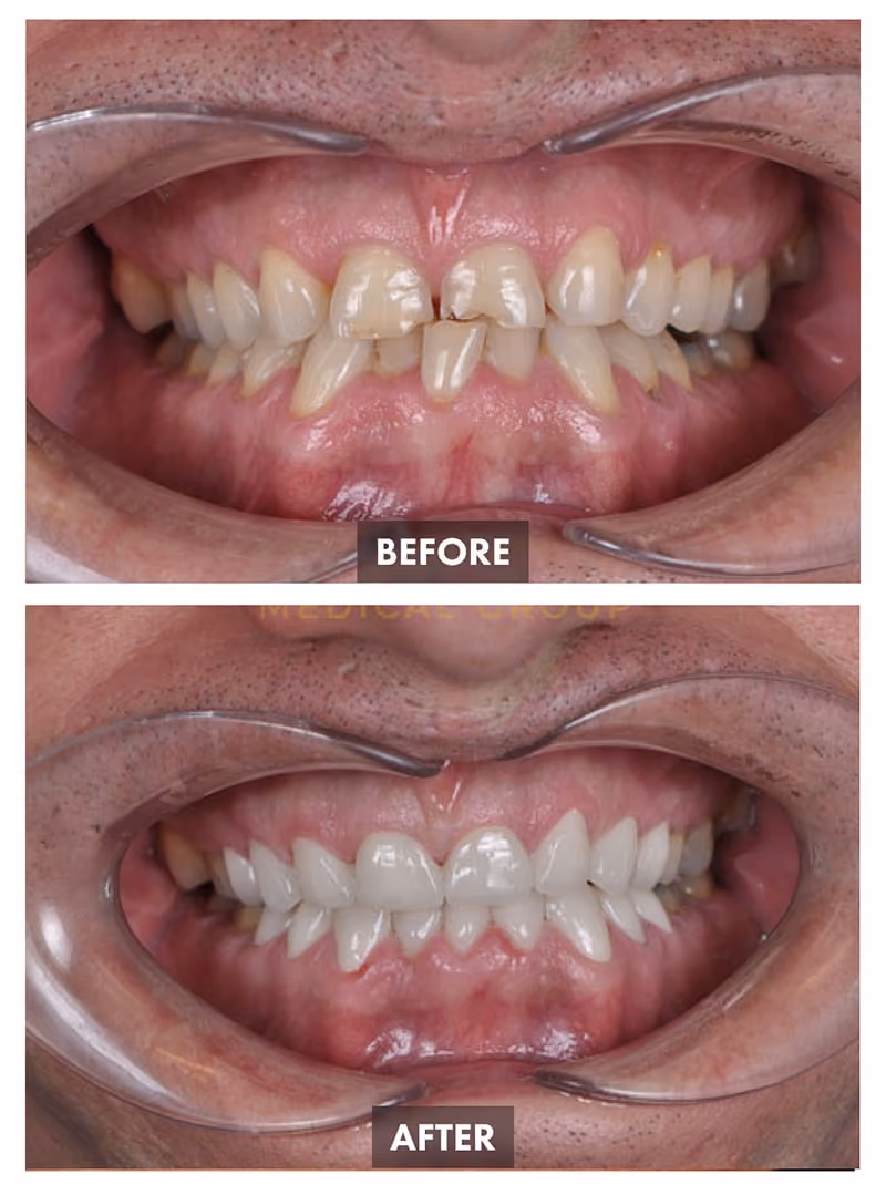 Dentistry Before-after Images - Este