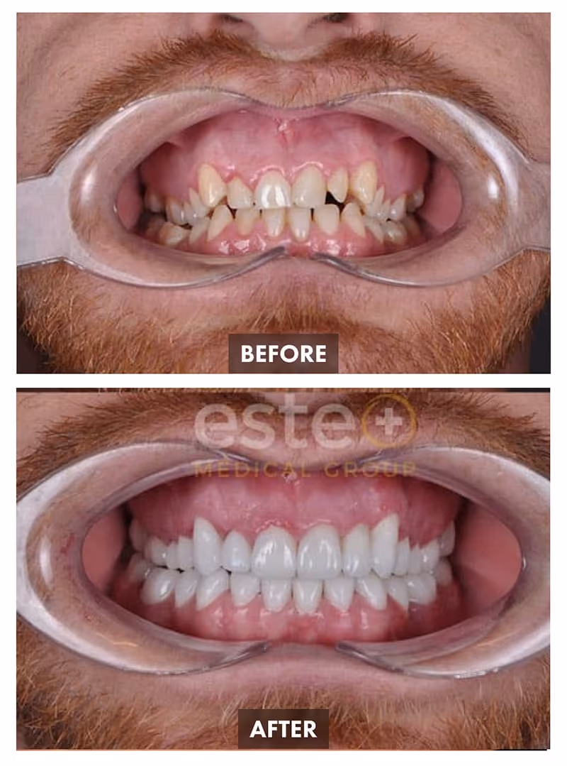Dentistry Before-after Images - Este