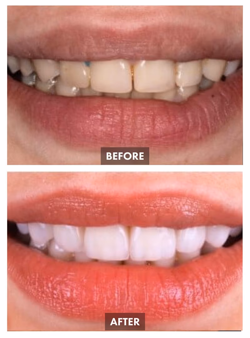 Dentistry Before-after Images - Este