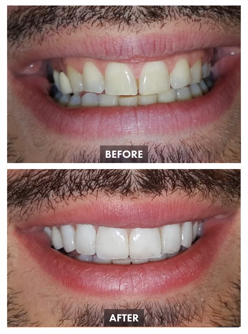 Dentistry Before-after Images - Este