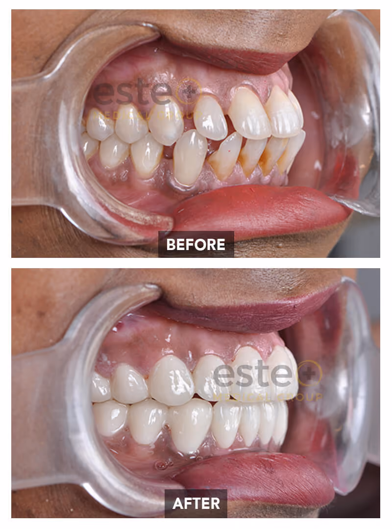 Nima - Dentistry Before after images